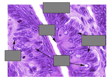 <p><span><strong>Label the arrows. What is the most likely biopsy source?</strong></span></p>