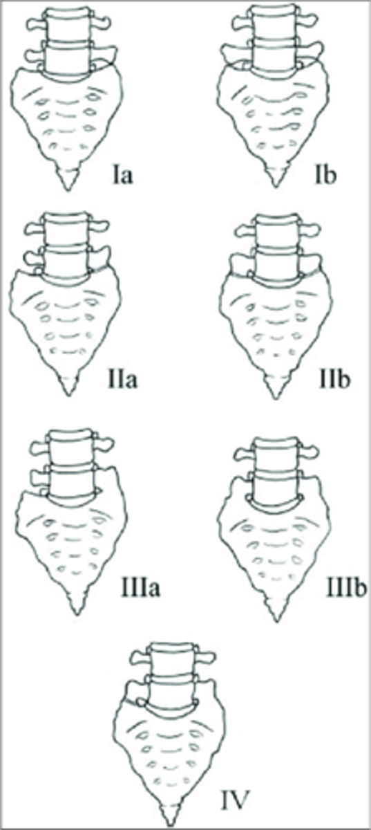 <p>- L5 can act like a sacral segment or even become part of the sacrum (sacralization of L5)</p><p>- S1 can act like a lumbar segment, or become a full lumbar segment (lumbarization of S1)</p><p>- Can be difficult to tell which of the two has occurred (must count the thoracic vertebral bodies for an accurate conclusion)</p>