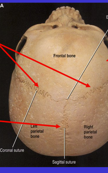 <p>What is the bottom arrow suture?</p>