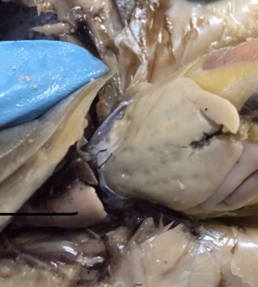 <p>heart: pumps blood</p>