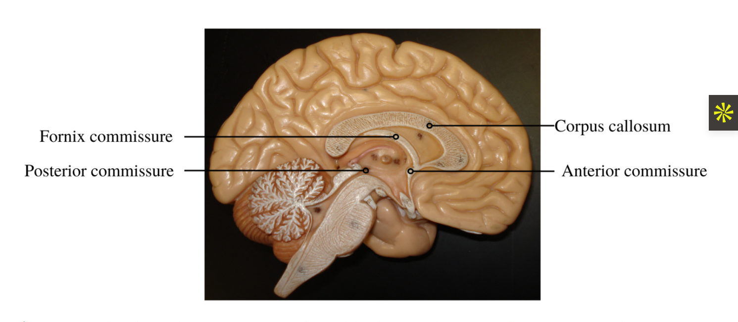 <p>anterior commissure fiber &gt; string located right above third ventricle and right below columns of fornix</p><p></p><p>posterior commisure fiber &gt;&nbsp;above superior collucli and above poeing of cerebral aqeuduct</p>