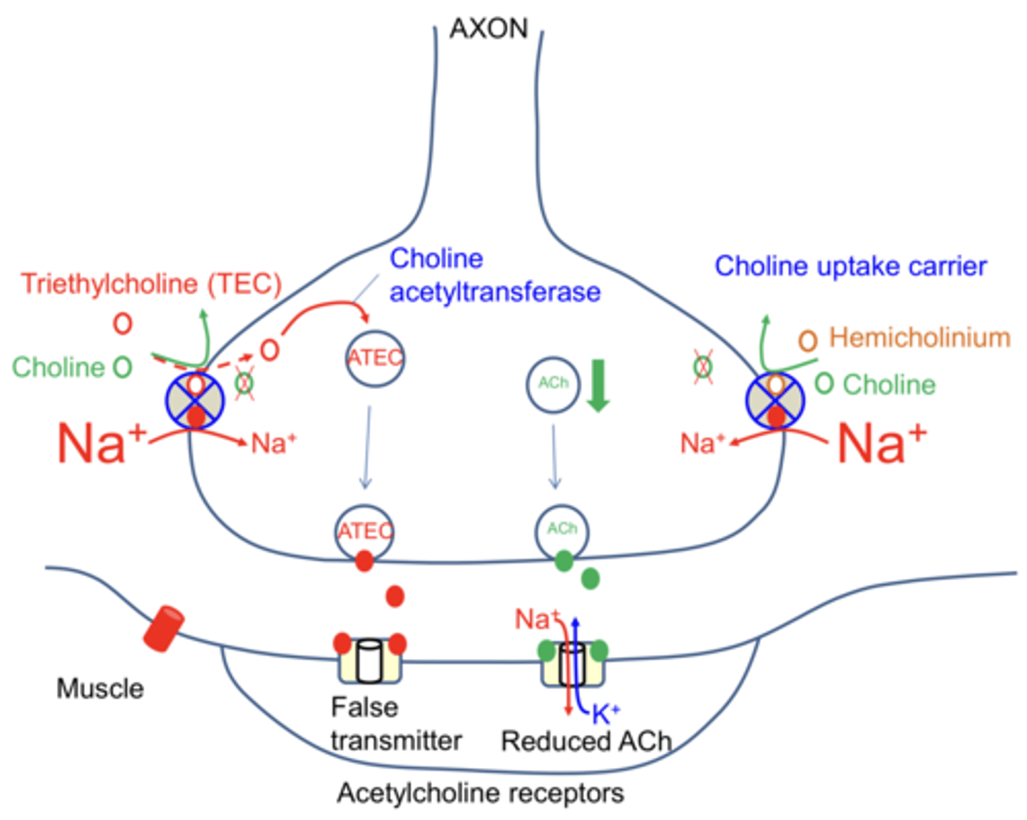 <p>Physical block of choline uptake carrier causes reduced amount of Ach in each vesicle and a reduced amount of Ach in the synapse</p>