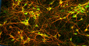 <p>What neurons are pictured? </p>