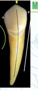 <p><mark data-color="#ffc1ec" style="background-color: #ffc1ec; color: inherit">mandibular canines #22 and #27; cusp tip</mark></p>