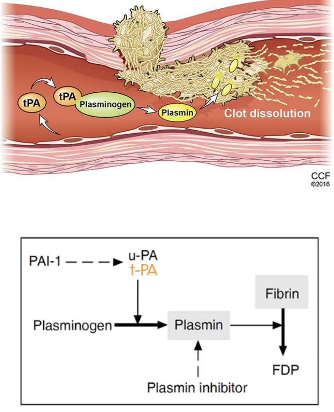 <ol><li><p>coagulação</p></li><li><p>fibrinólise</p></li></ol><p></p><p>Plasmina <strong>corta</strong> ligações de fibrina, está no sangue sob a forma de <strong>plasminogénio</strong>, que é ativada com <strong>ativadores</strong>, que estão no <strong>sangue </strong>ou na <strong>parede do vaso lesado.</strong></p><p></p><p><strong>Conversão do plasminogénio em plasmina por:</strong></p><ul><li><p>Ativador do plasminogénio tecidular <strong>(tPA)</strong> → está no vaso lesado</p></li><li><p>Ativador do plasminogénio do tipo urocinase (uPA) → circulante</p></li><li><p>Calicreína</p><p></p></li></ul><p>A plasmina <strong>degrada</strong>:</p><ul><li><p>Fibrina (Ia), fibrinogénio (I), fatores V, VIII, XII, protrombina (II)</p></li></ul><p>Entre os produtos da degradação da fibrina encontram-se os <strong>dímeros</strong>, importantes para <strong>marcar a existencia </strong>ou não de um processo de <strong>trombose</strong>.</p><p></p><p></p>