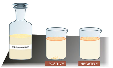 <p><span><span>A common test for liver damage involves sprinkling sulfur powder onto a sample of urine. Sulfur powder sprinkled on a healthy individual with normal liver function will float (negative result), while the sulfur powder sprinkled on urine sample of individual with unhealthy liver function will sink (positive result). See figure below. Which of the following best explain why the sulfur powder sink?</span></span></p>