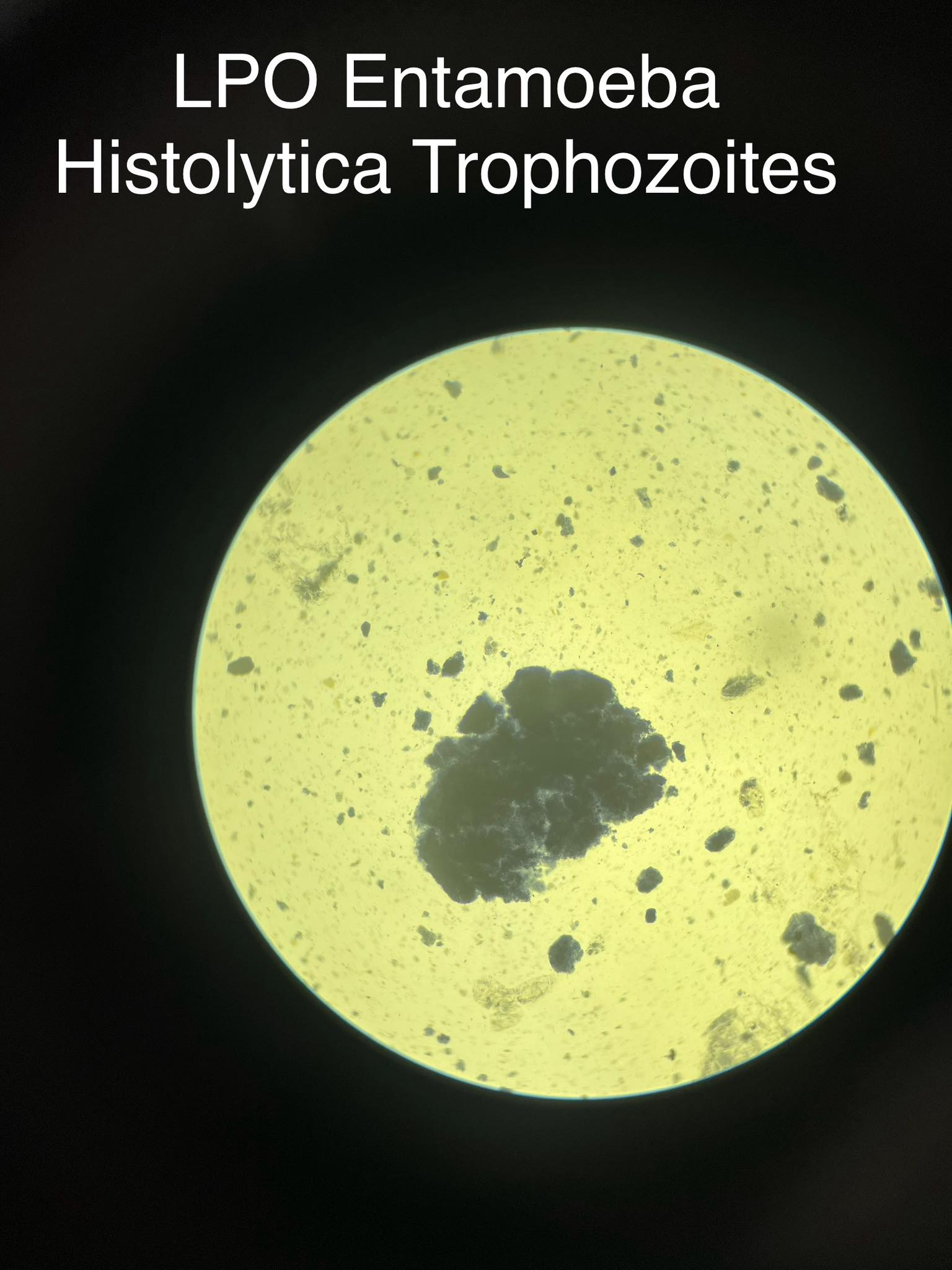 <p>Entamoeba histolytica</p>