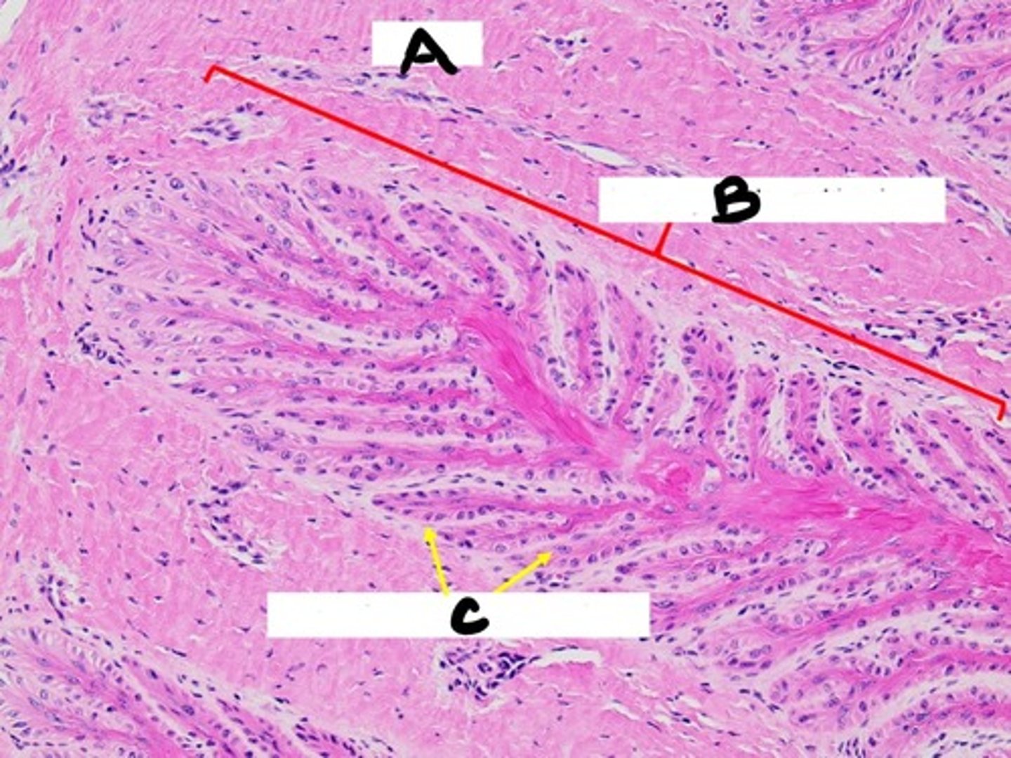 <p>perpendicular to primary laminae</p><p>- increase surface area &amp; resistance to separation</p>