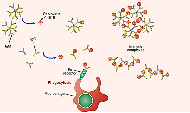 <p>A <strong>strong antibody response</strong> creates <strong>immune complexes</strong> that get deposited in the <strong>skin and joints</strong>, leading to the <strong>characteristic rash</strong> and <strong>arthralgia </strong></p>