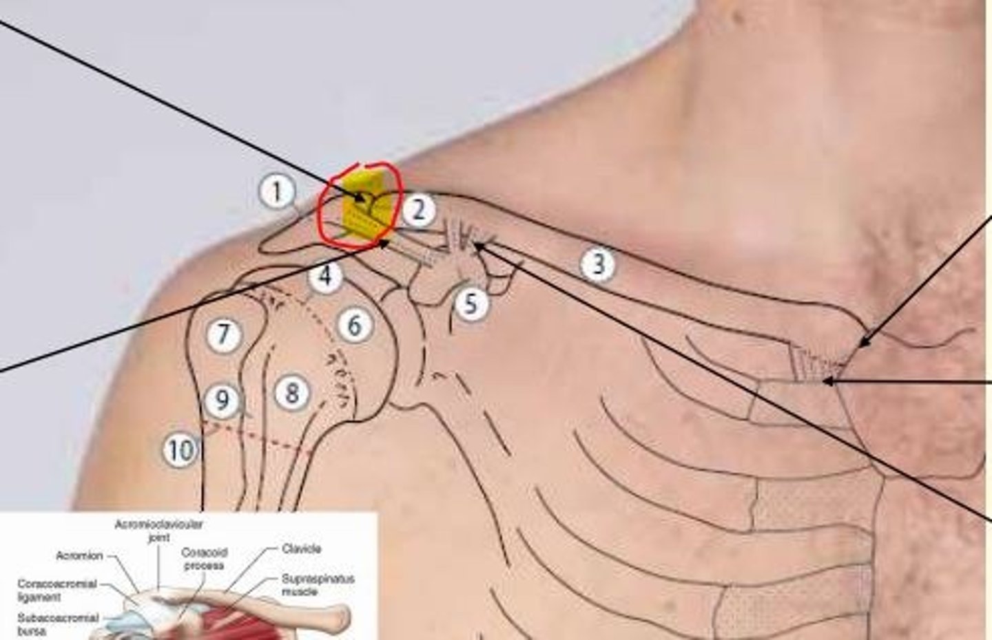 <p>Acromioclavicular (AC) joint</p><p>- Joint line passes from anterior to posterior</p><p>- Dislocation can result in shoulder separation & visible deformity</p>