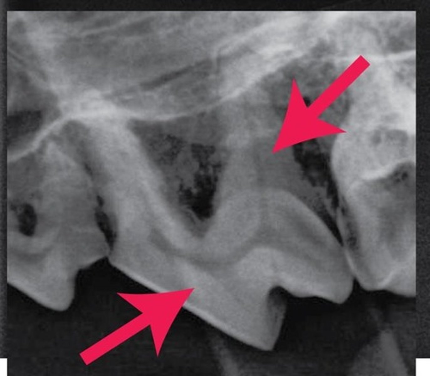<p>The arrows are pointing to what substance that makes up the bulk of the internal tooth, deep to the enamel and cement?</p>