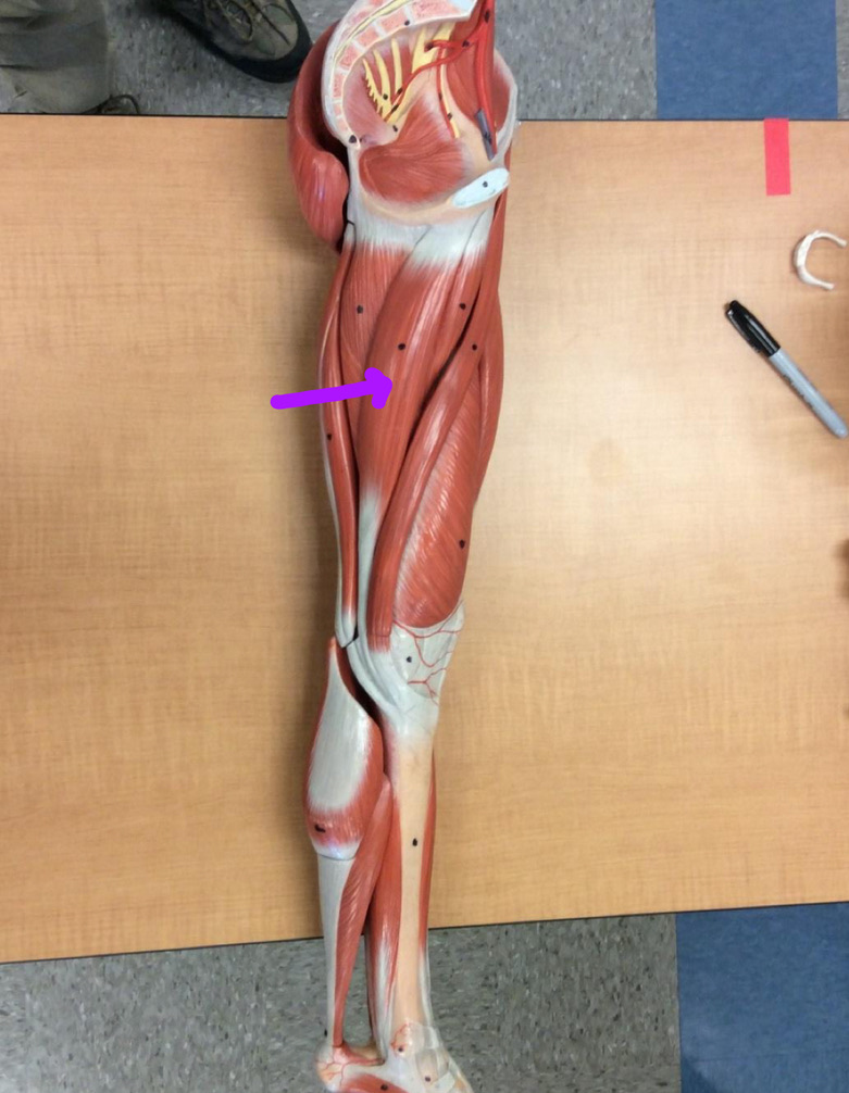 <p>Identify this muscle?</p>