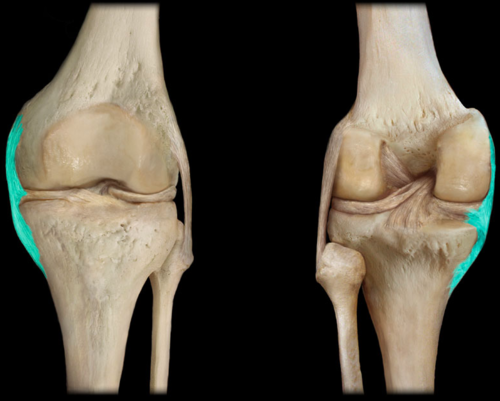 - Valgus Force at the knee and/or external rotation of the tibia. force that comes from the outside to inside. 
•Foot planted
•Direct blow
- ligament on the inside. mcl runs from femur to fibula.