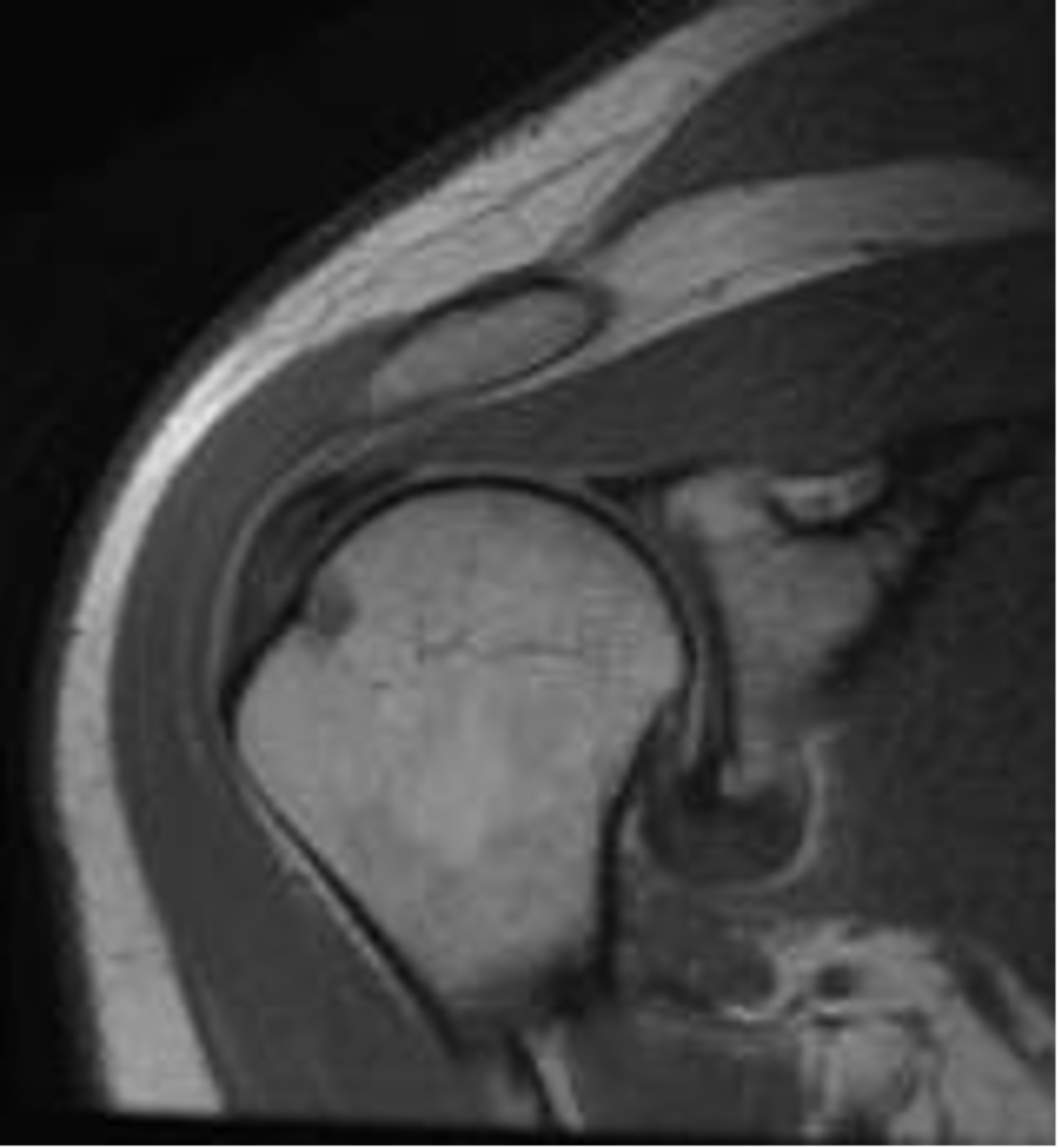 <p>What is this image depicting? How do you know?</p>