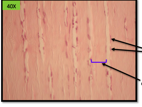 densely packed with collagen fibers. 

makes up tendons(bone-muscle)

ligament(bone-bone)