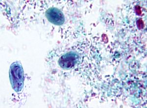 G. lamila cysts
