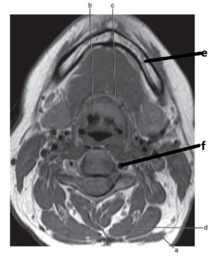 <p>What is letter c ?</p>