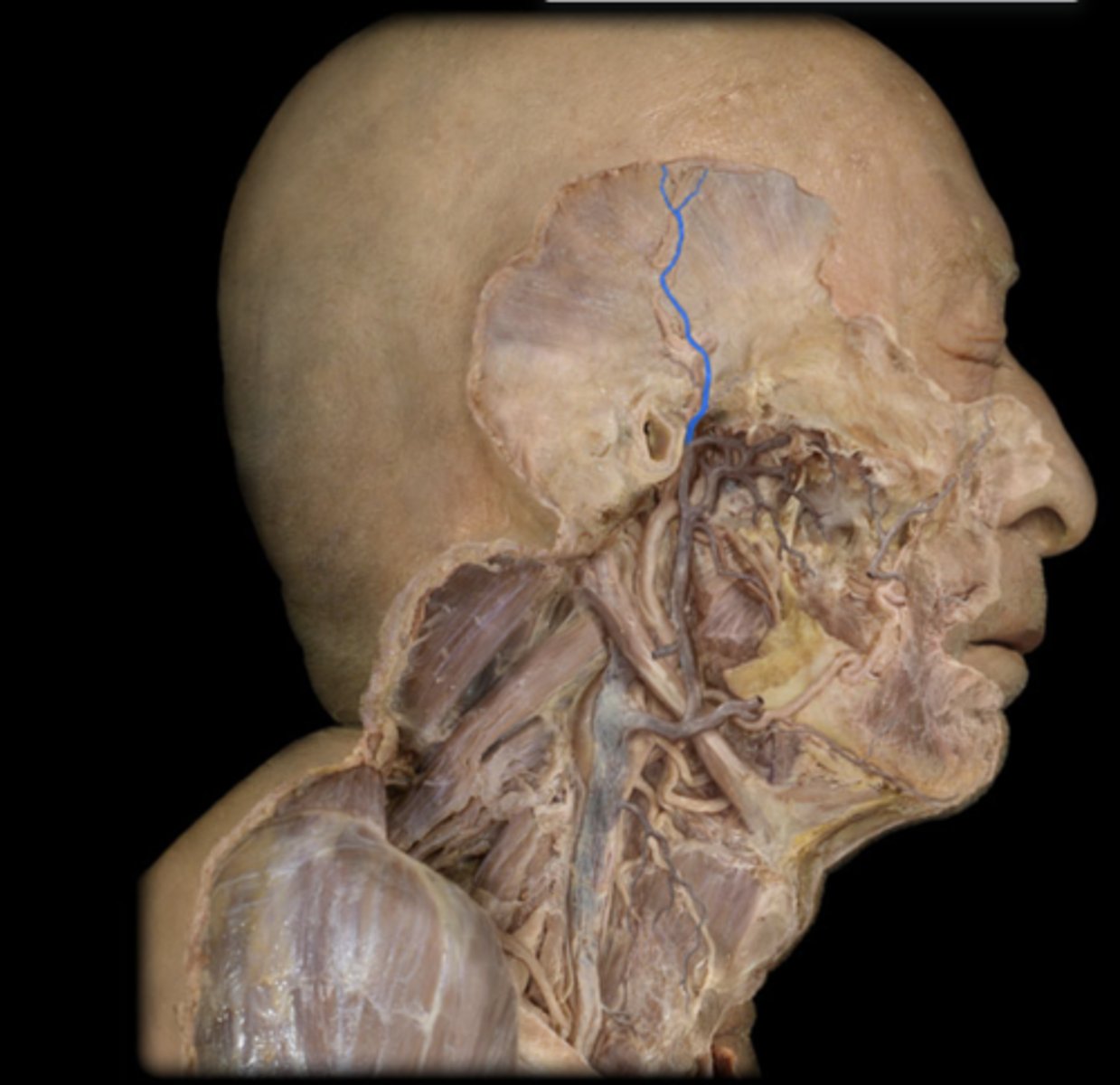 <p>drains blood from the forehead, parietal, temporal regions</p>