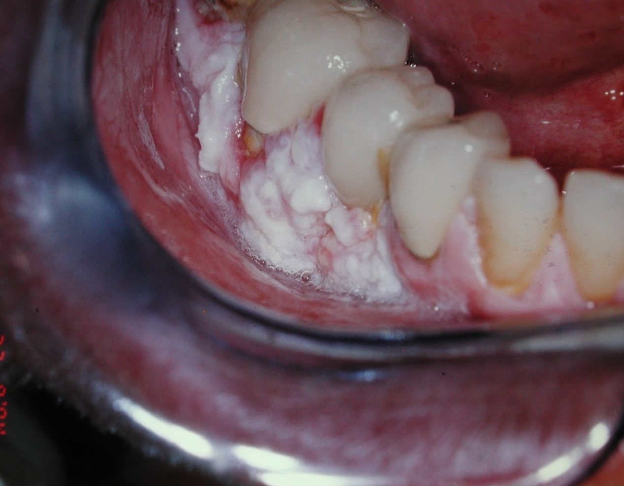 <p>what is the most likely diagnosis? </p>