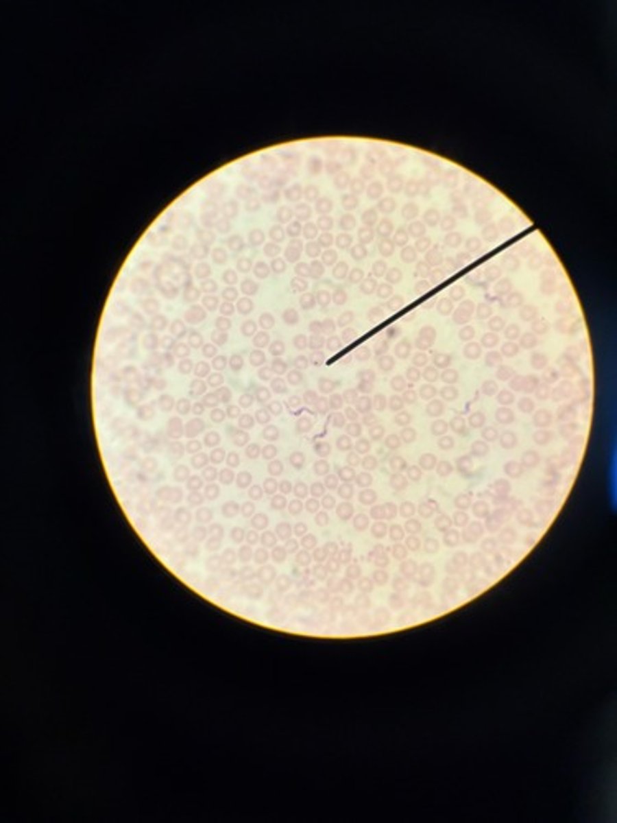<p>Identify</p>