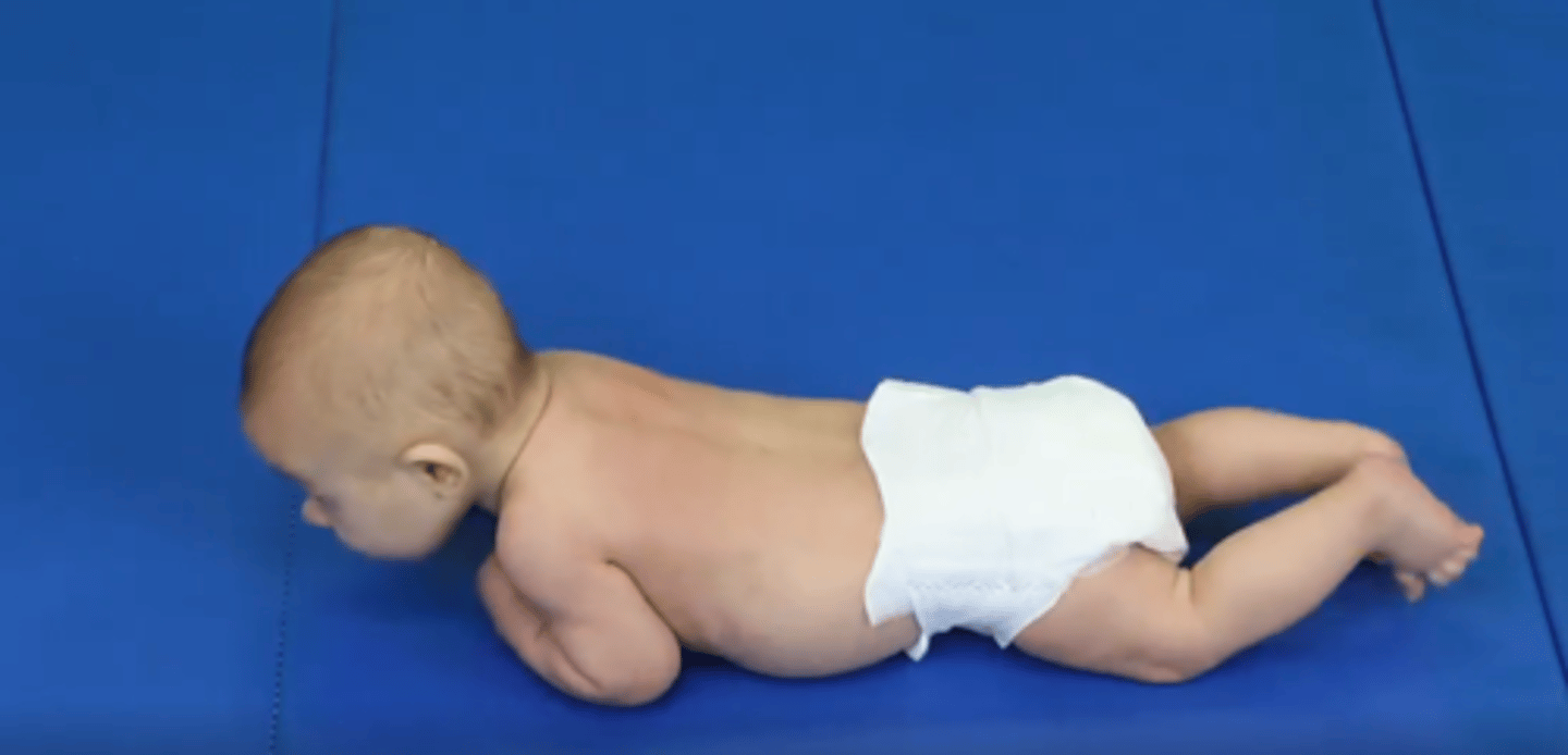 <p>1. Head mostly in midline</p><p>2. Head held consistently to 45 extension</p><p>3. Developing extension in upper trunk</p><p>4. Props up on forearms (AKA prone on elbows/prone puppy)</p>