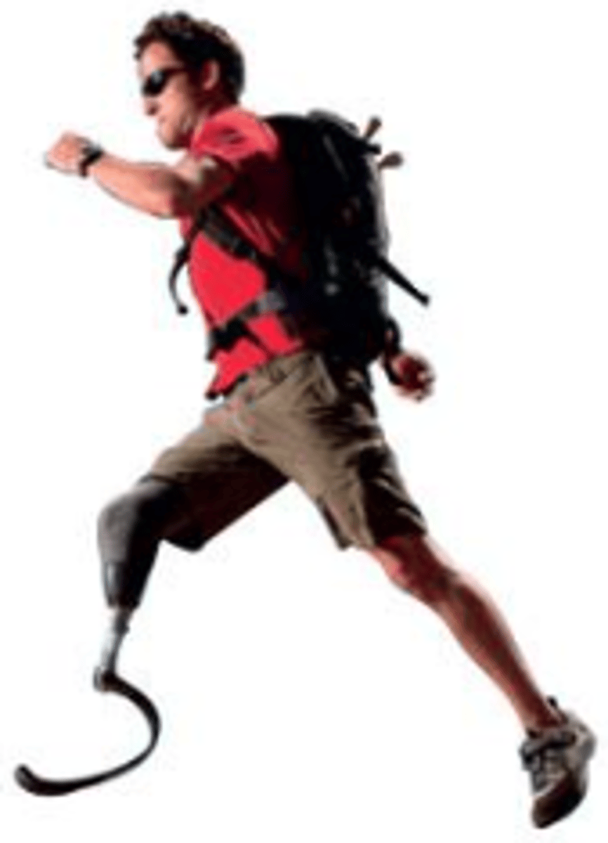 <p>(cắt cụt chi)______ is when a person's limbs, fingers, or toes are removed during surgery.</p>
