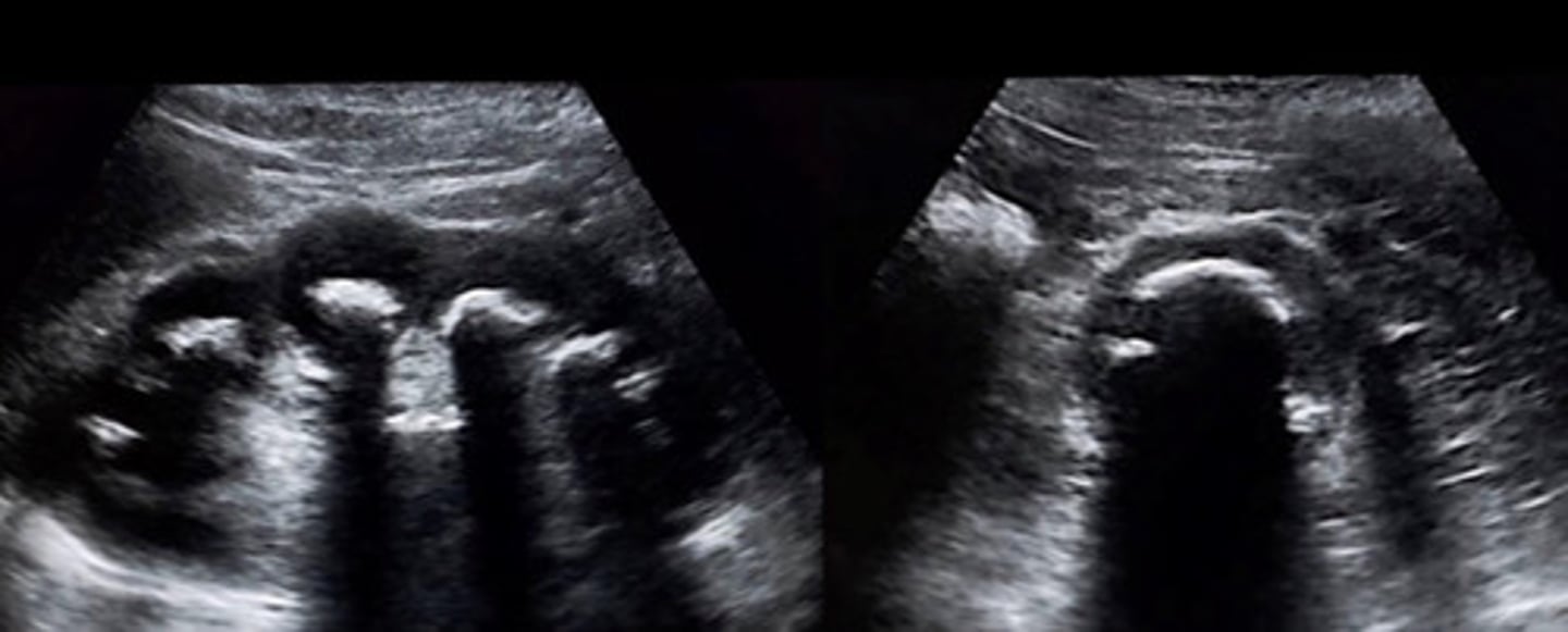 <p>What does this image show</p>