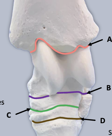 <p>what joint is peach</p>