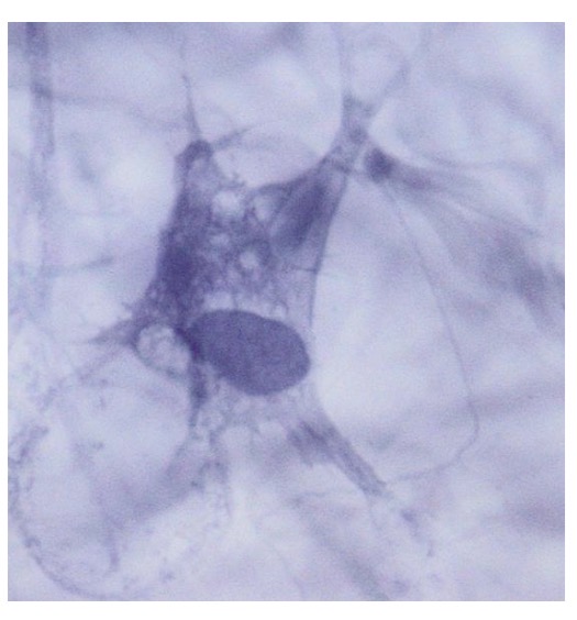 <p>• Aktyviai sintetina tarpląstelinės medžiagos komponentus</p><p>• Jautrūs augimo faktoriams</p><p>• Branduolys ovalus, euchromatiškas, matomas branduolėlis, gerai išvystytas šiurkštusis ET ir Goldžio aparatas</p>