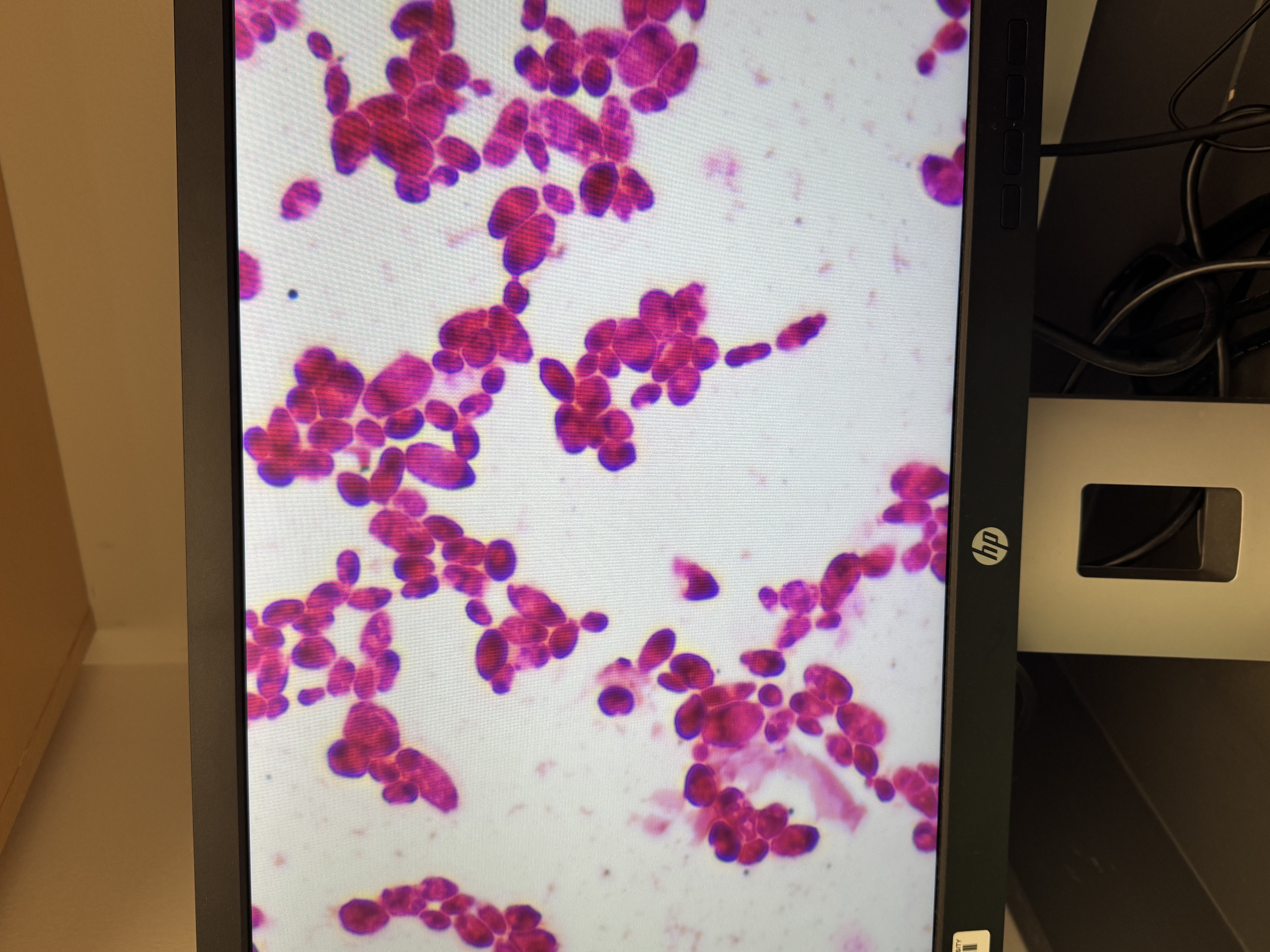 <p>Candida albicans</p>