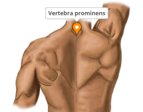 <p><span>The existence of a long and prominent spinous process which is palpable from the skin surface</span></p>