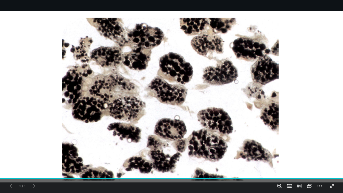 <p>identify </p><p>mention the stain</p>