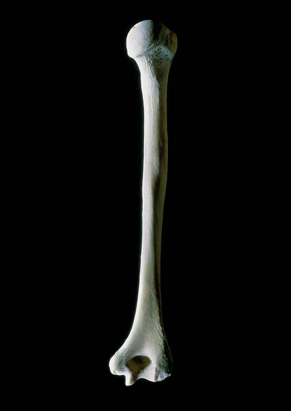 <p>Is the Humerus shown right or left?</p>