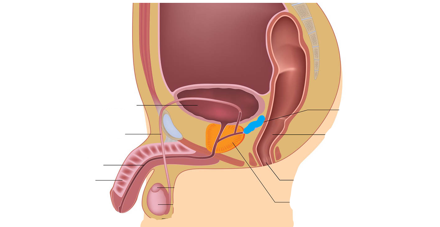 <p>What part of the male reproductive system is this?</p>