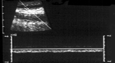<p>what does this waveform represent</p>