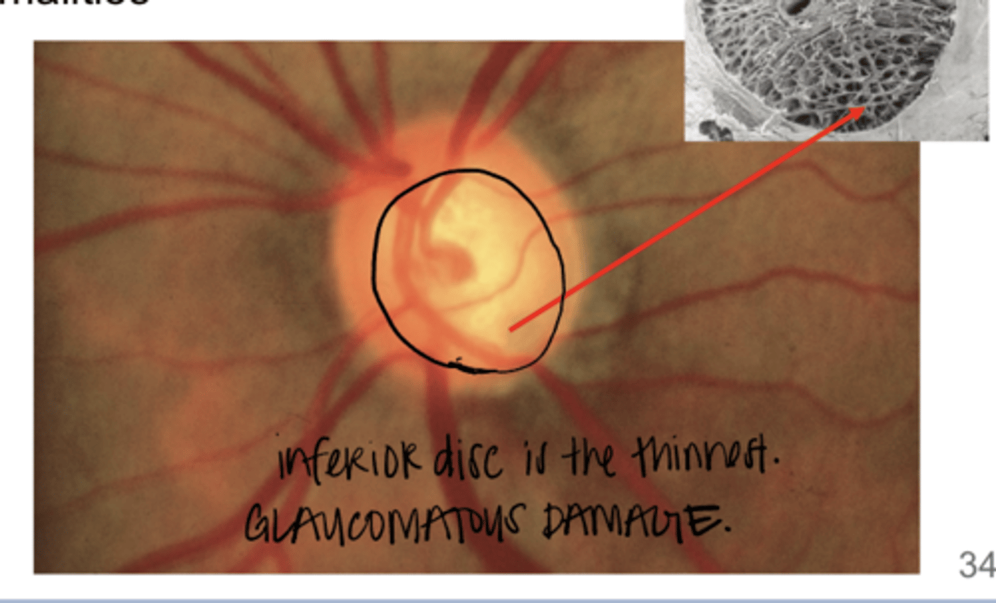 <p>Does this nerve follow the ISNT rule?</p>