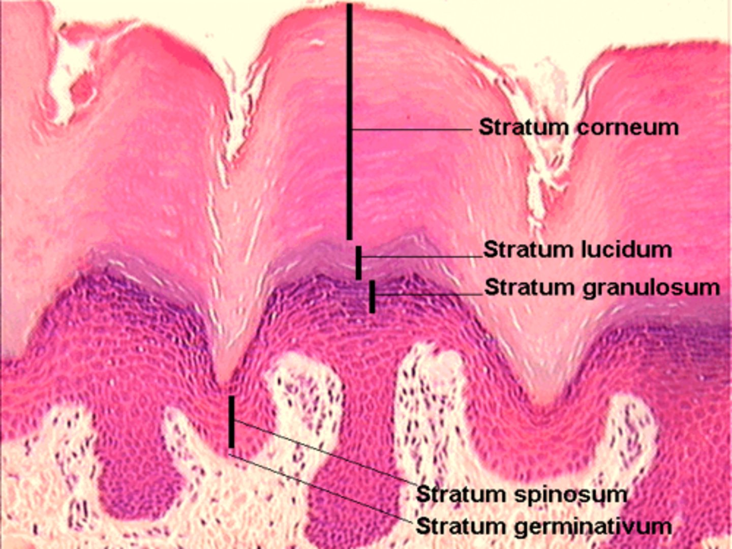 <p>found only in the thick skin</p><p>translucent layer of of eledin protein that fills the cell</p>