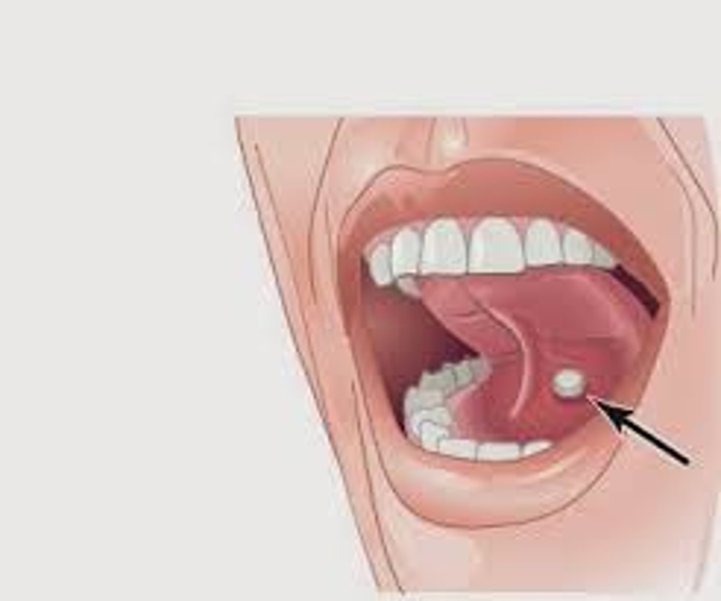 <p>sublingually, under the tongue</p>