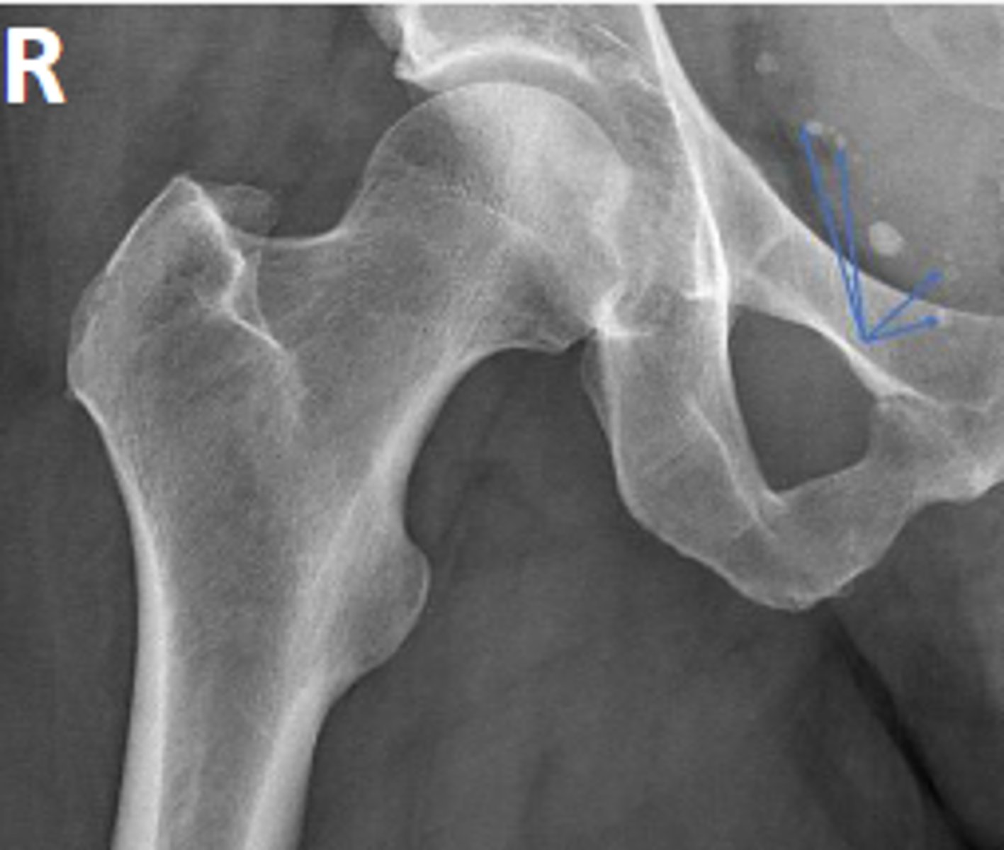 <p>What are the arrows pointing to?</p>