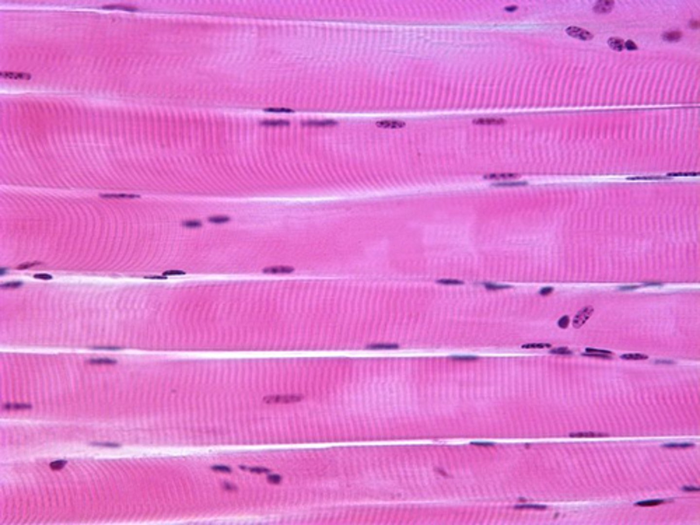 <p>-striated</p><p>-voluntary</p><p>-most attach to bone</p><p>-multiple nuclei in cells</p>