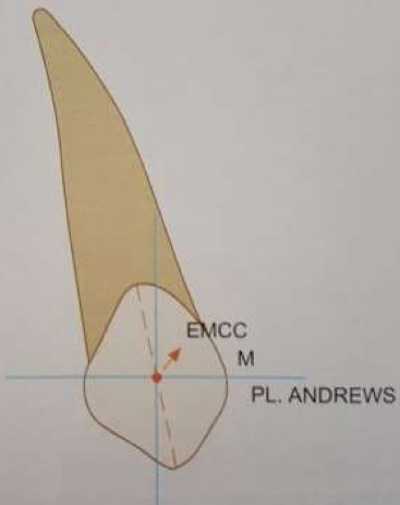 <p>Gingival portion of long axis of each crown should be distal to incisal portion</p>