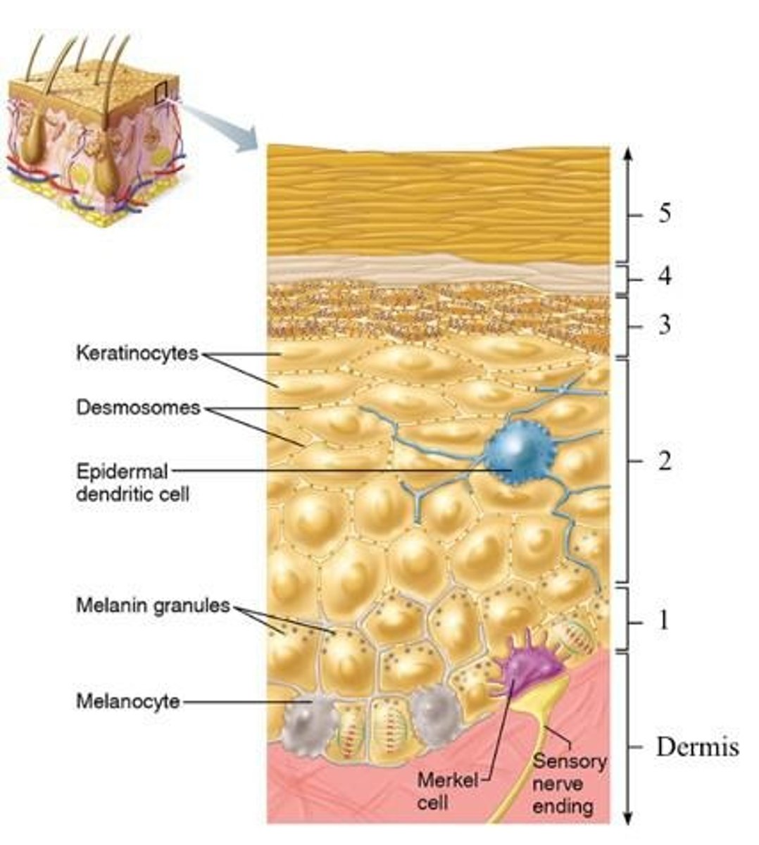 <p>Least malignant skin cancer, slow-growing.</p>