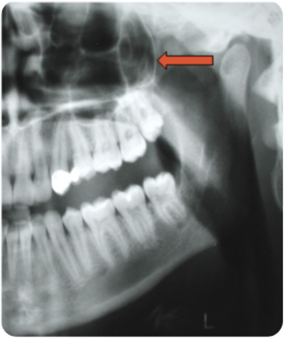 knowt flashcard image