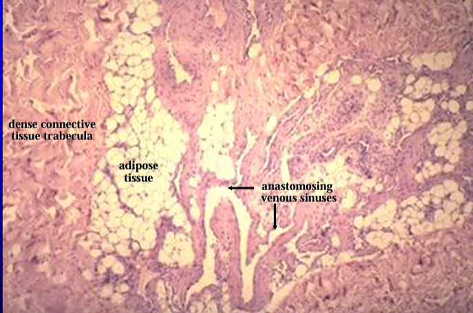 <p>Canine penis. </p><p>The erectile body (corpus cavernosum penis) is seen at a higher magnification. It contains adipose tissue and anastomosing venous sinuses</p>