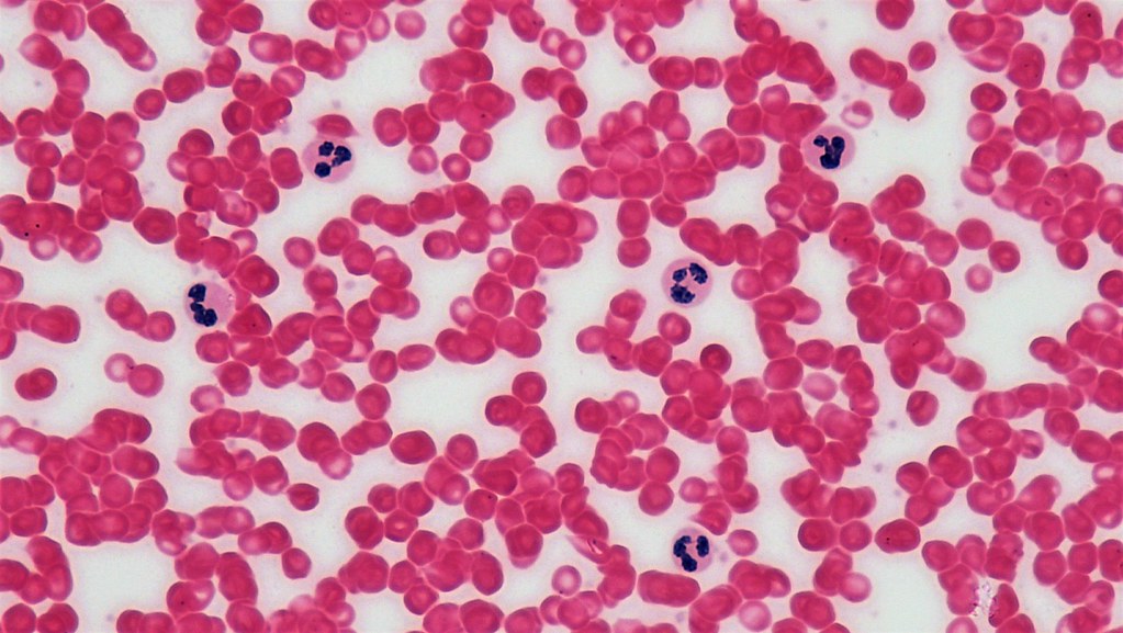 <p>Which connective tissue is this?</p>