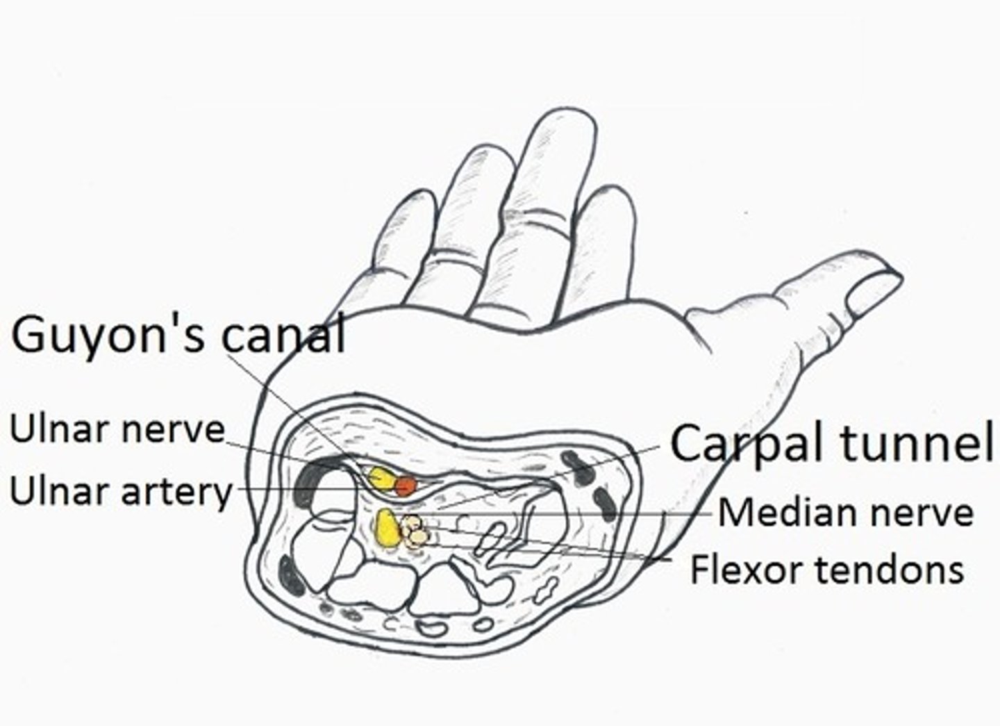 <p>What is Guyon canal syndrome?</p><p>- compression of the ulnar nerve at the wrist or hand</p><p>What kind of people typically get these injuries?</p><p>- classically seen in cyclists due to pressure from the handle bars</p>