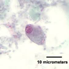 <p>Identify this 12 µm parasite.<br><br></p><p>Balantidium coli</p><p>Chilomastix mesnili</p><p>Giardia lamblia</p><p>Trichomonas hominis</p><p>None of the above</p>