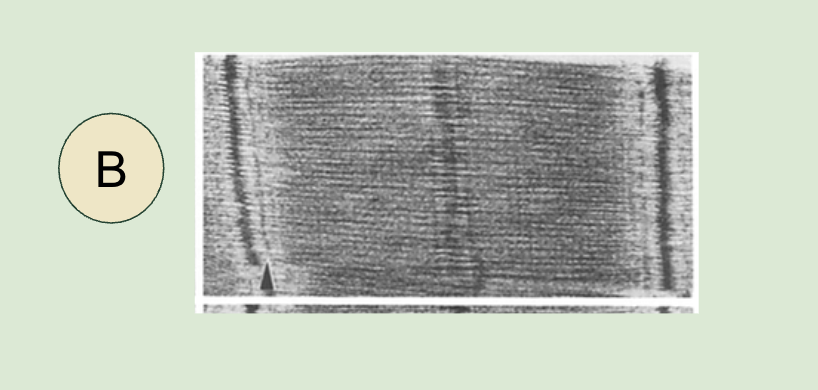 <p>Micrograph of contracted Sacromere </p><ul><li><p>as the light band is much shorter, and the Z lines are closer to the center of the sarcomere.</p></li></ul><p></p>