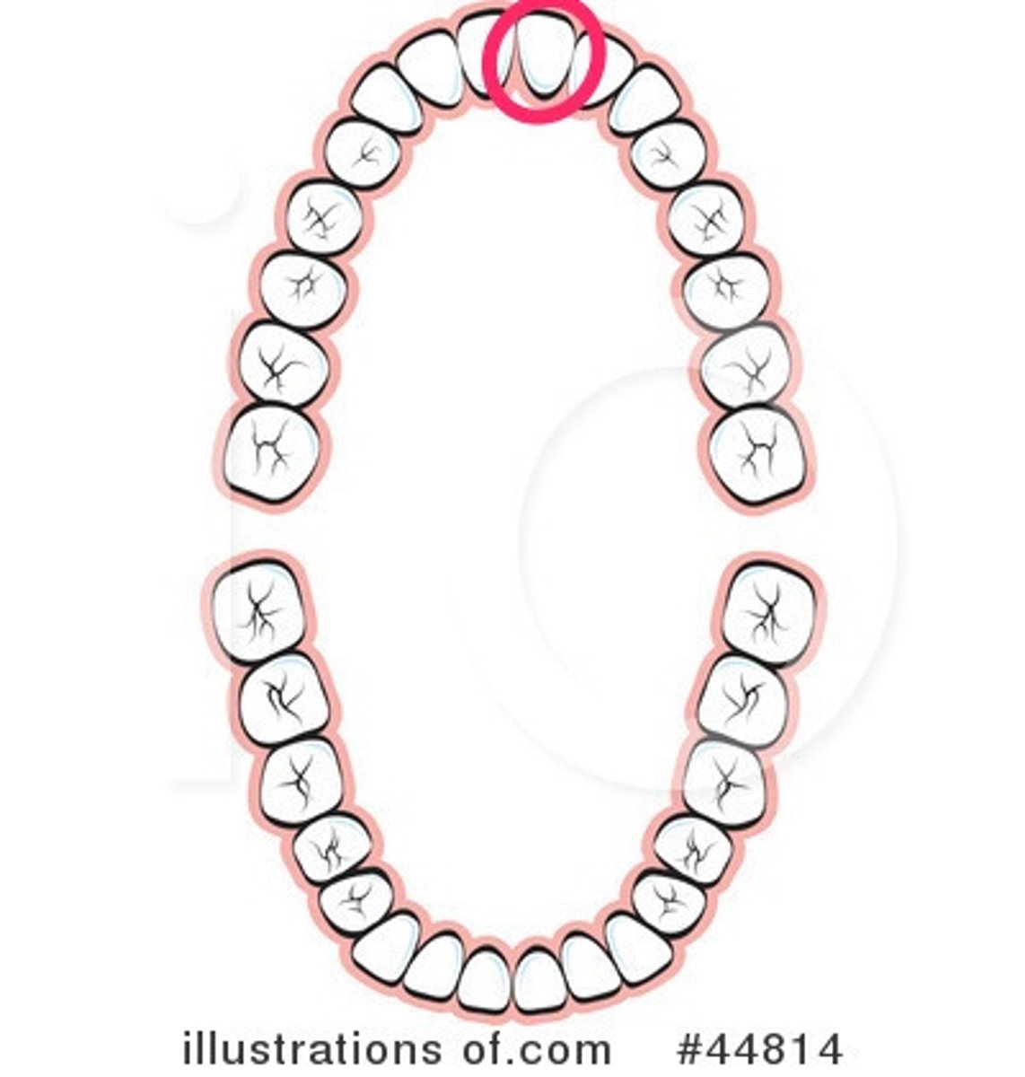 <p>UL central incisor</p>