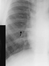 <p>diagnosis</p>